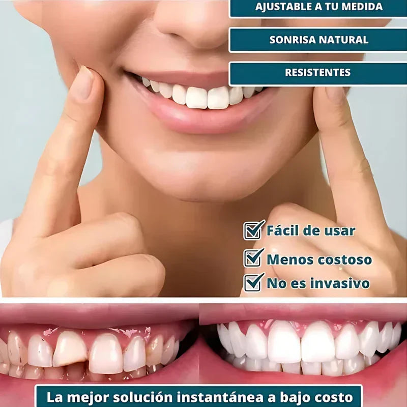 SmilePro 🦷 - Carillas Dentales Ajustables De Resina + ESTUCHE REGALO - ¡Últimas unidades!
